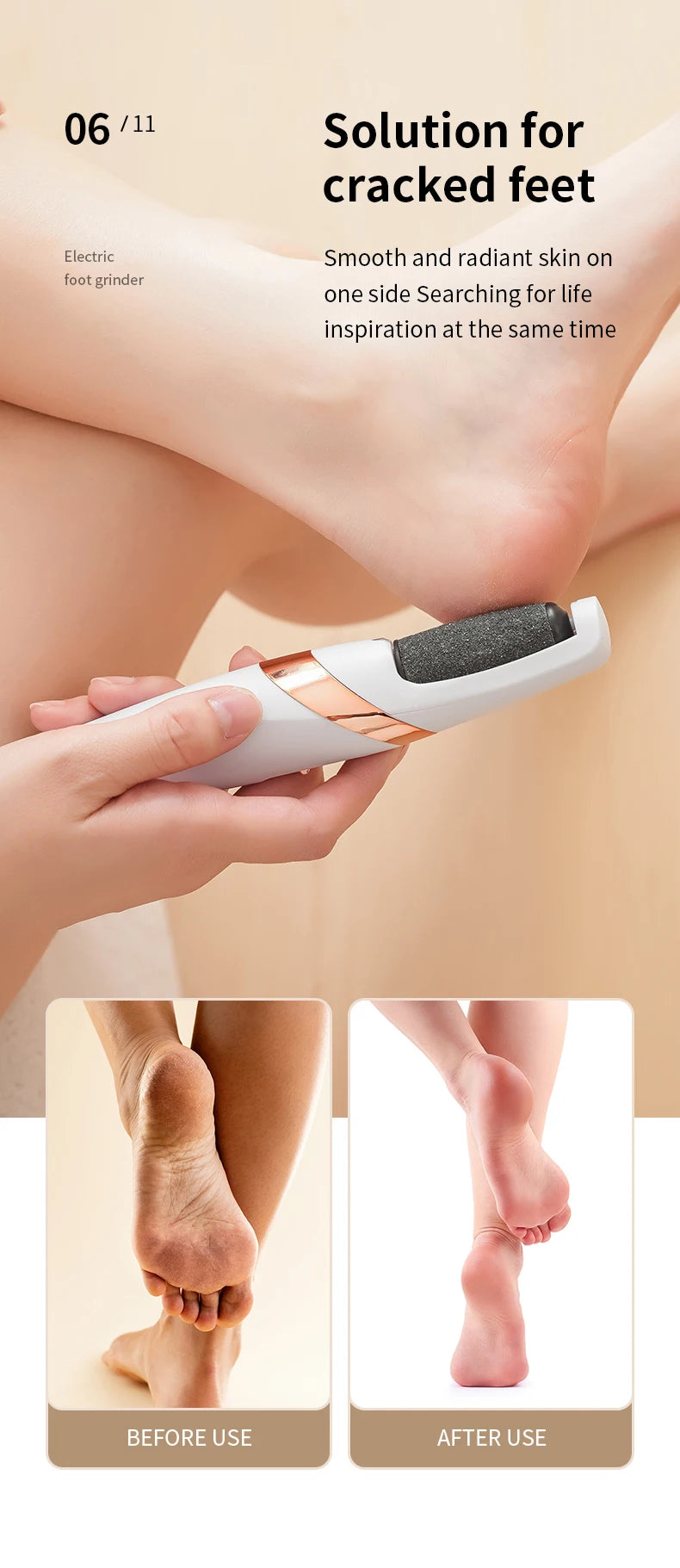 Foot Callus Remover